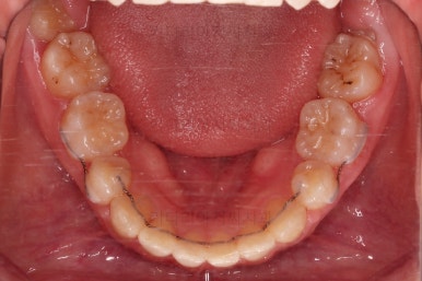 부산연산동교정치과