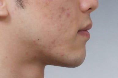 부산주걱턱교정