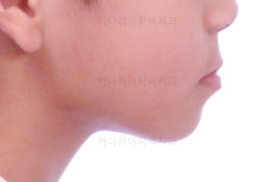 부산어린이교정