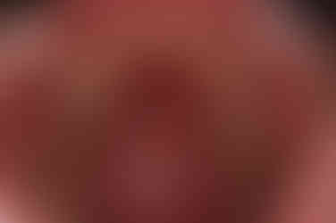 부산부분치아교정