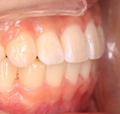 연산동교정치과