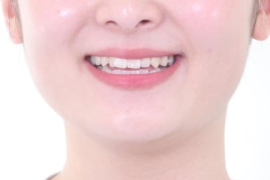 부산교정치과