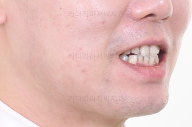 부산교정치과