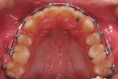 부산교정치과추천