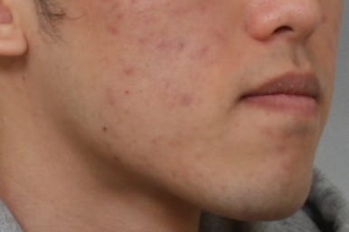 부산주걱턱교정