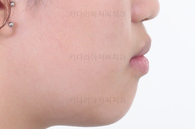 사직동교정치과