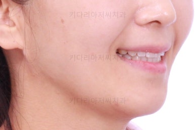 부산인비절라인