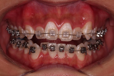 부산치아교정치과