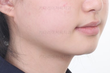 동래구치아교정