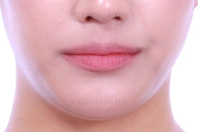 연산동치아교정치과