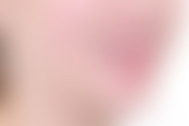 부산개방교합