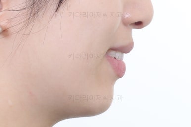 부산연산동부분교정