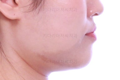 부산치아교정잘하는곳