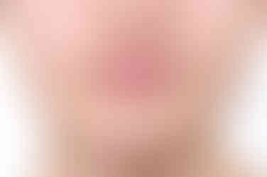 부산비발치교정