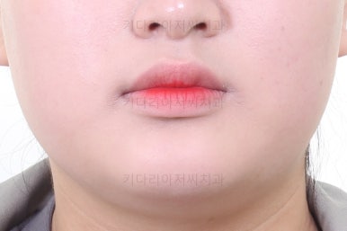 부산교정치과추천