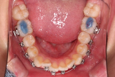 부산치아교정치과