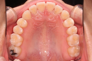 부산인비절라인