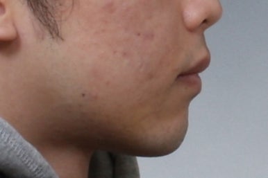 부산주걱턱교정