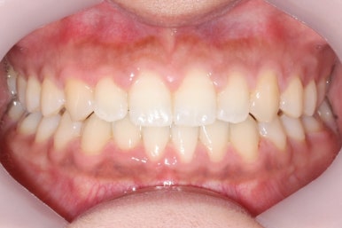 부산치아교정치과