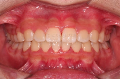 부산청소년교정