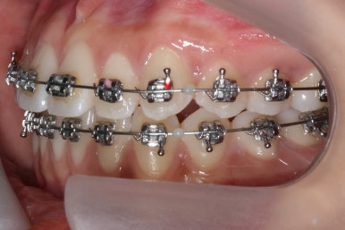 부산연산동청소년교정
