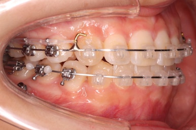 연산동교정치과