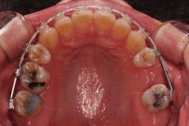 부산재교정치과