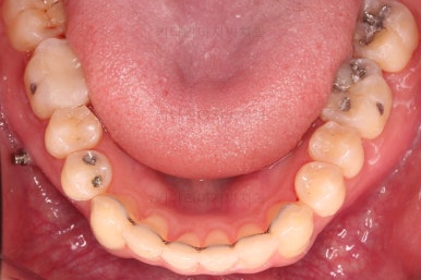 부산연제구교정