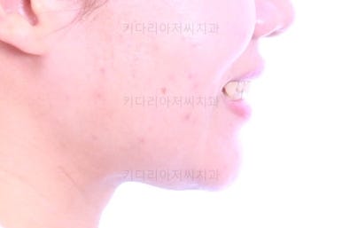 부산치아교정치과