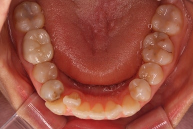 부산인비절라인