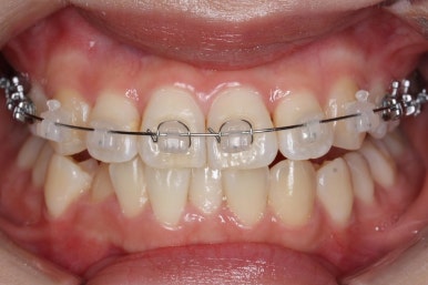 연산동교정치과