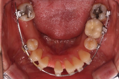 부산재교정치과