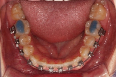 부산치아교정치과