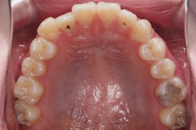 부산치아교정잘하는곳