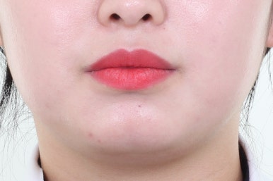 부산치아교정치과