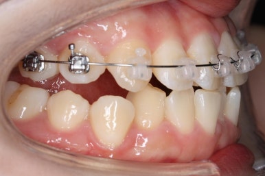 연산동교정치과