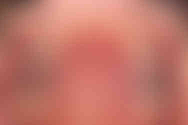 부산연산동교정치과