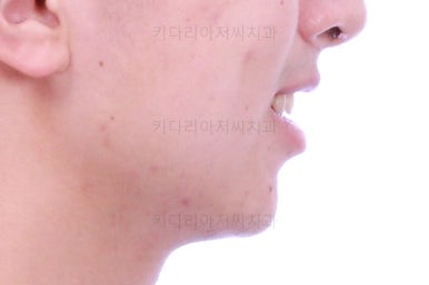 부산교정치과추천