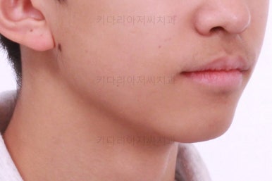 부산교정치과추천