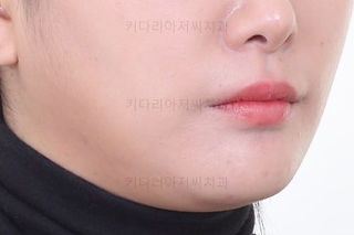 부산치아교정
