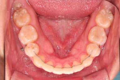 연산동치아교정치과