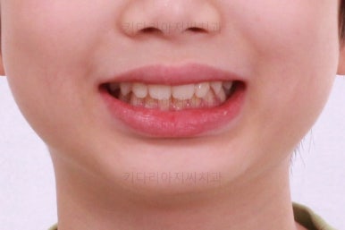 부산어린이교정