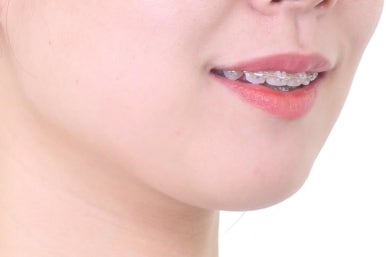 부산연산동교정치과