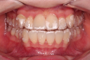 부산교정전문의