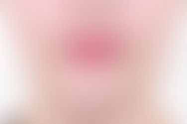 부산개방교합