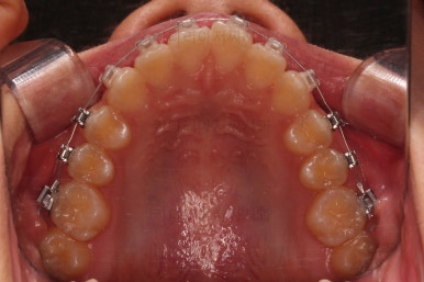 부산교정전문의