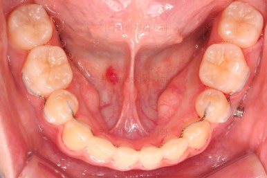 동래구치아교정