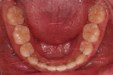 사직동교정치과