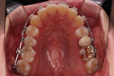 부산비대칭교정