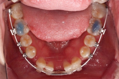 부산교정치과추천